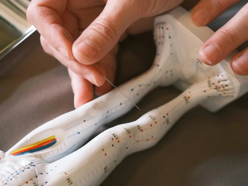 Acupuncture at Care Natural Wellness Center in Melbourne