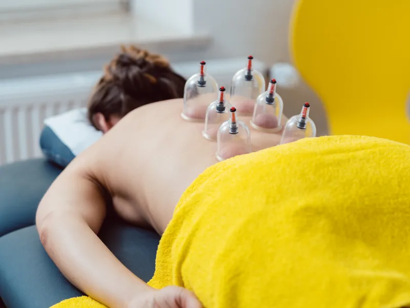 Cupping Therapy at Care Natural Wellness Center in Melbourne