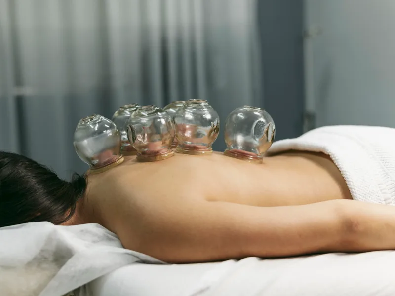 Cupping Therapy at Care Natural Wellness Center in Melbourne