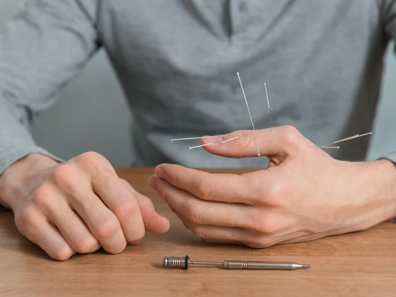 Dry Needling at Care Natural Wellness Center in Melbourne
