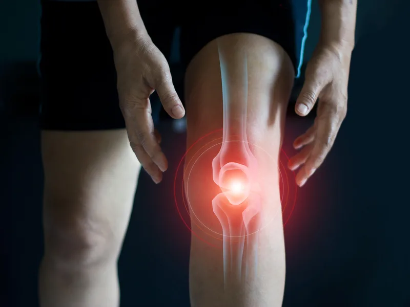 How Care Natural Wellness Center treats arthritis in Melbourne